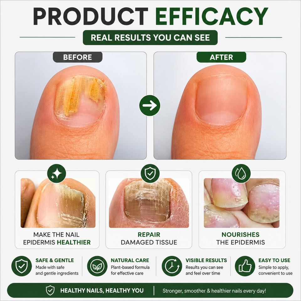 Herbal Nail Fungus Treatment Oil