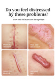 Silicone Scar Cream for Old and New Scars